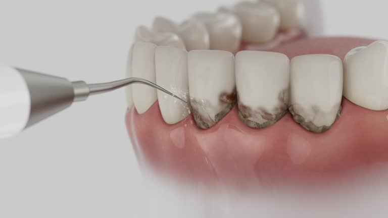 Reliable Dental Implants contractor in Speers, PA by Smile Center Dentistry